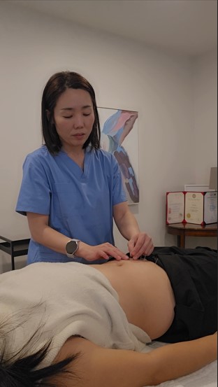 Sun Lee providing attentive acupuncture treatment at RootCare